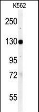 Vinculin Antibody in Western Blot (WB)