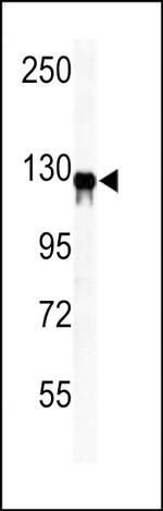 Vinculin Antibody in Western Blot (WB)