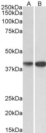 ENDOGL1 Antibody in Western Blot (WB)