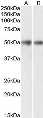 GDE1 Antibody in Western Blot (WB)