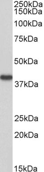 HAO2 Antibody in Western Blot (WB)