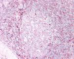 HLA-B Antibody in Immunohistochemistry (Paraffin) (IHC (P))