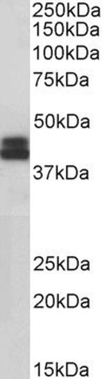 HLA-B Antibody in Western Blot (WB)