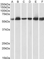 HSP60 Antibody in Western Blot (WB)