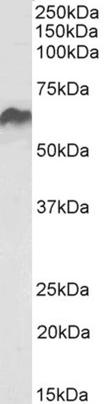 HSP60 Antibody in Western Blot (WB)