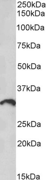 CD275 (B7-H2) Antibody in Western Blot (WB)