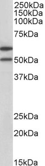 IL13RA2 Antibody in Western Blot (WB)