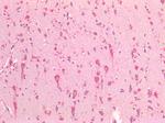 GRP78 Antibody in Immunohistochemistry (Paraffin) (IHC (P))