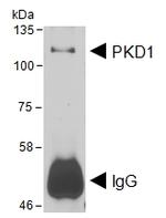 PKC mu Antibody in Western Blot (WB)