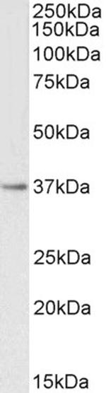 PTGR1 Antibody in Western Blot (WB)