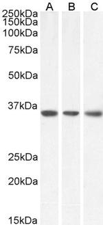 MDH2 Antibody in Western Blot (WB)