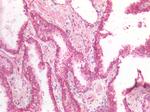 MDH2 Antibody in Immunohistochemistry (Paraffin) (IHC (P))