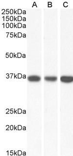 MDH2 Antibody in Western Blot (WB)