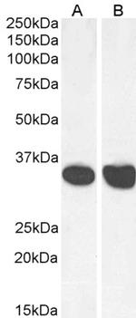 MDH2 Antibody in Western Blot (WB)