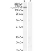 ACE2 Antibody in Western Blot (WB)