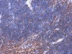 Phospho-BTK (Tyr223) Antibody in Immunohistochemistry (Paraffin) (IHC (P))