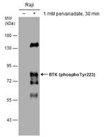 Phospho-BTK (Tyr223) Antibody in Western Blot (WB)