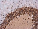 Phospho-IRS1 (Ser307) Antibody in Immunohistochemistry (Paraffin) (IHC (P))