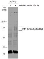 Phospho-IRS1 (Ser307) Antibody in Western Blot (WB)