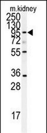 ADAM9 Antibody in Western Blot (WB)