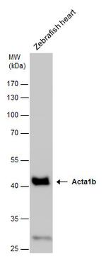 ACTA1b Antibody in Western Blot (WB)