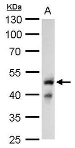 GLI2 Antibody in Western Blot (WB)