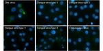 Zika Virus prM (strain H/PF/2013) Antibody in Immunocytochemistry (ICC/IF)