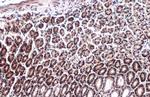 p300 Antibody in Immunohistochemistry (Paraffin) (IHC (P))