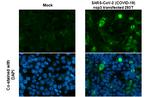 SARS-CoV-2 NSP3 (strain Wuhan-Hu-1) Antibody in Immunocytochemistry (ICC/IF)