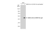 SARS-CoV-2 NSP3 (strain Wuhan-Hu-1) Antibody in Western Blot (WB)