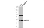 SLC17A3 Antibody in Western Blot (WB)