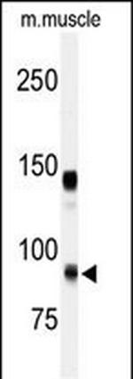 ADAMTS5 Antibody in Western Blot (WB)