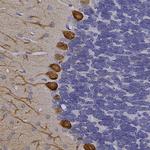 Calbindin D28K Antibody in Immunohistochemistry (Paraffin) (IHC (P))