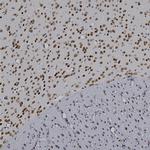 MECP2 Antibody in Immunohistochemistry (Paraffin) (IHC (P))