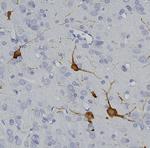 Tyrosine Hydroxylase Antibody in Immunohistochemistry (Paraffin) (IHC (P))