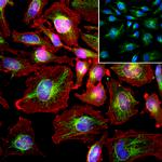 Vimentin Antibody in Immunocytochemistry (ICC/IF)