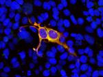 Cas9 Antibody in Immunocytochemistry (ICC/IF)