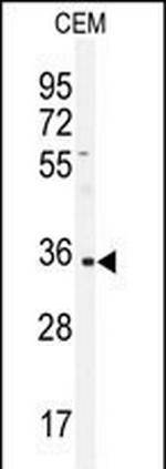 IGHA1 Antibody in Western Blot (WB)