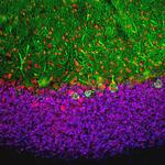 MECP2 Antibody in Immunohistochemistry (PFA fixed) (IHC (PFA))