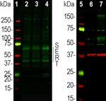 SLC6A4 Antibody in Western Blot (WB)