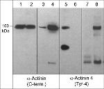 Phospho-alpha Actinin 4 (Tyr4) Antibody in Western Blot (WB)