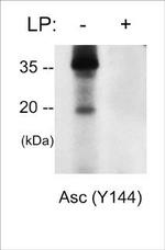 Phospho-PYCARD (Tyr144) Antibody in Western Blot (WB)