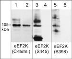 Phospho-EEF2K (Ser445) Antibody in Western Blot (WB)