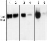 Phospho-EGFR (Ser1142) Antibody in Western Blot (WB)