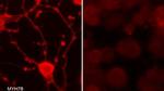 MYH7B Antibody in Immunocytochemistry (ICC/IF)