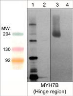 MYH7B Antibody in Western Blot (WB)