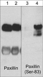 Phospho-Paxillin (Ser83) Antibody in Western Blot (WB)