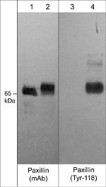 Phospho-Paxillin (Tyr118) Antibody in Western Blot (WB)