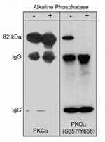 Phospho-PKC alpha (Ser657, Tyr658) Antibody in Western Blot (WB)