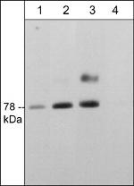 SMPD3 Antibody in Western Blot (WB)